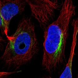 ZNF557 Antibody, Novus Biologicals:Antibodies:Primary Antibodies